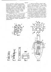 Зубной имплантат и способ его установки (патент 1547816)