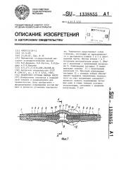 Эндопротез сустава пальца кисти (патент 1338855)