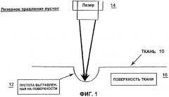 Способ увеличения объема пустот в прессовой ткани путем лазерного травления (патент 2349696)