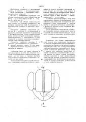 Устройство для обзора операционного поля полости рта (патент 1540797)