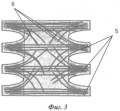 Устройство для пластики при послеоперационных грыжах передней брюшной стенки (патент 2553207)