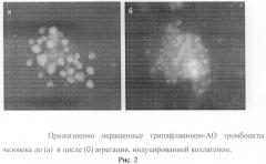 Способ оценки морфофункционального статуса тромбоцитов человека (патент 2485502)