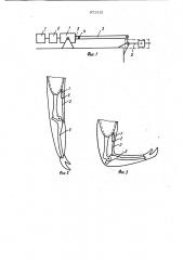 Электромеханический привод протезов конечностей (патент 971312)