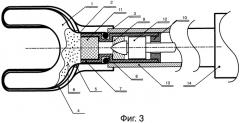 Устройство для получения слепков зубов и способ его использования (патент 2509541)