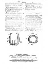 Зубная коронка (патент 624621)