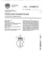 Устройство для осмотра глазного дна во время операции (патент 1616657)