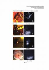 Способ интраоперационной визуализации ишемически-реперфузионного повреждения миокарда (патент 2622983)