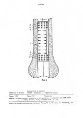 Штифт для остеосинтеза и устройство для его установки системы а.п.шлычкова и н.ш.пулатова (патент 1602497)
