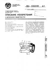 Способ соединения коронок и тела в мостовидных протезах (патент 1553102)