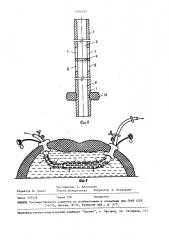Дренажное устройство (патент 1505555)