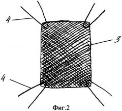 Способ герниопластики вентральных грыж (патент 2313293)
