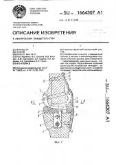 Искусственный коленный сустав (патент 1664307)