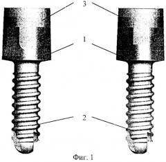 Стоматологический винтовой имплантат (патент 2246281)