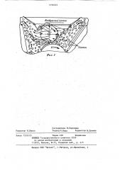 Пильчатая секция очистителя хлопка-сырца (патент 1196423)