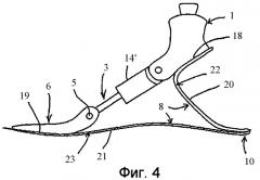 Искусственная стопа (патент 2434606)