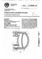 Искусственный желудочек сердца (патент 1713595)