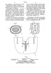 Способ изготовления штифтового зуба (патент 1138148)