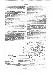 Окклюзирующее устройство (патент 1695940)