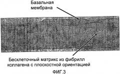 Стерильный аутологичный, аллогенный или ксеногенный имплантат и способ его изготовления (патент 2478403)