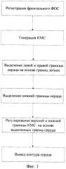 Способ определения контура сердца на флюорографических снимках (патент 2478337)