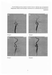 Способ выбора системы защиты головного мозга от эмболии при стентировании бифуркации общей сонной артерии в зависимости от особенностей стенотического поражения (патент 2609206)