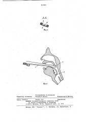 Устройство для обследования гортани (патент 957851)