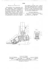 Искусственная стопа (патент 679208)