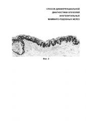 Способ дифференциальной диагностики опухолей аногенитальных маммароподобных желез (патент 2626123)