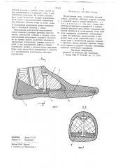 Искусственная стопа (патент 698619)