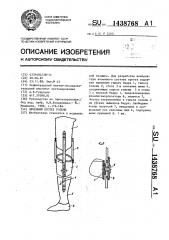 Лечебный протез голени (патент 1438768)