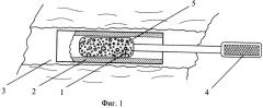 Устройство для гемостаза при эндоскопических операциях на почках (патент 2318457)