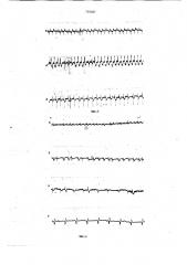 Способ моделирования аритмий сердца (патент 749387)