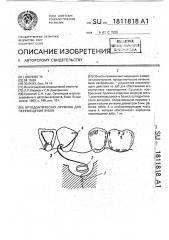 Ортодонтическая пружина для перемещения зубов (патент 1811818)