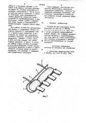 Устройство для аортальной контрпульсации (патент 921569)