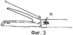 Усовершенствование приводного хирургического сшивающего инструмента (патент 2529375)