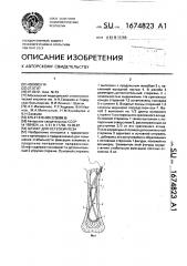 Штифт для остеосинтеза (патент 1674823)