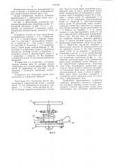 Устройство для сближения краев раны (патент 1243708)