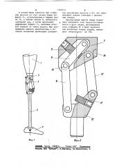 Протез бедра (патент 1109153)