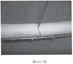 Способ лечения несросшихся переломов и ложных суставов длинных костей (патент 2359632)