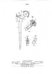 Искусственный тазобедренный сустав (патент 508982)