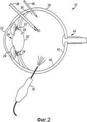 Белый когерентный лазерный свет, пропускаемый через нановолокна для хирургического освещения (патент 2569714)