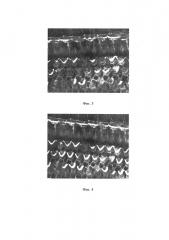 Средство для лечения нейросенсорной потери слуха (варианты) (патент 2614487)