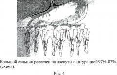 Способ хирургического лечения цирроза печени в эксперименте (патент 2570526)