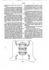 Способ лапаростомии при лечении гнойного перитонита (патент 1748800)