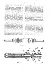 Устройство для массажа (патент 1419700)