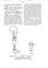 Протез для недоразвитой нижней конечности (патент 1212425)