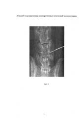 Способ моделирования дегенеративных изменений позвоночника (патент 2584136)