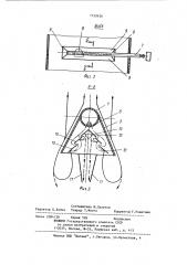Шунтирующая труба (патент 1150436)
