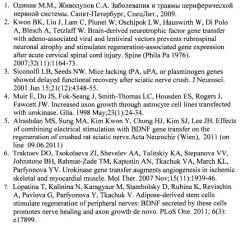 Способ стимулирования восстановления периферической иннервации тканей с помощью векторных конструкций (патент 2486918)