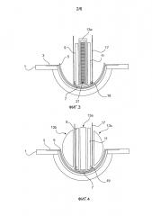 Способ изготовления роторных лопастей ветроэнергетической установки, а также изготовления для этого формовочного стержня (патент 2611502)